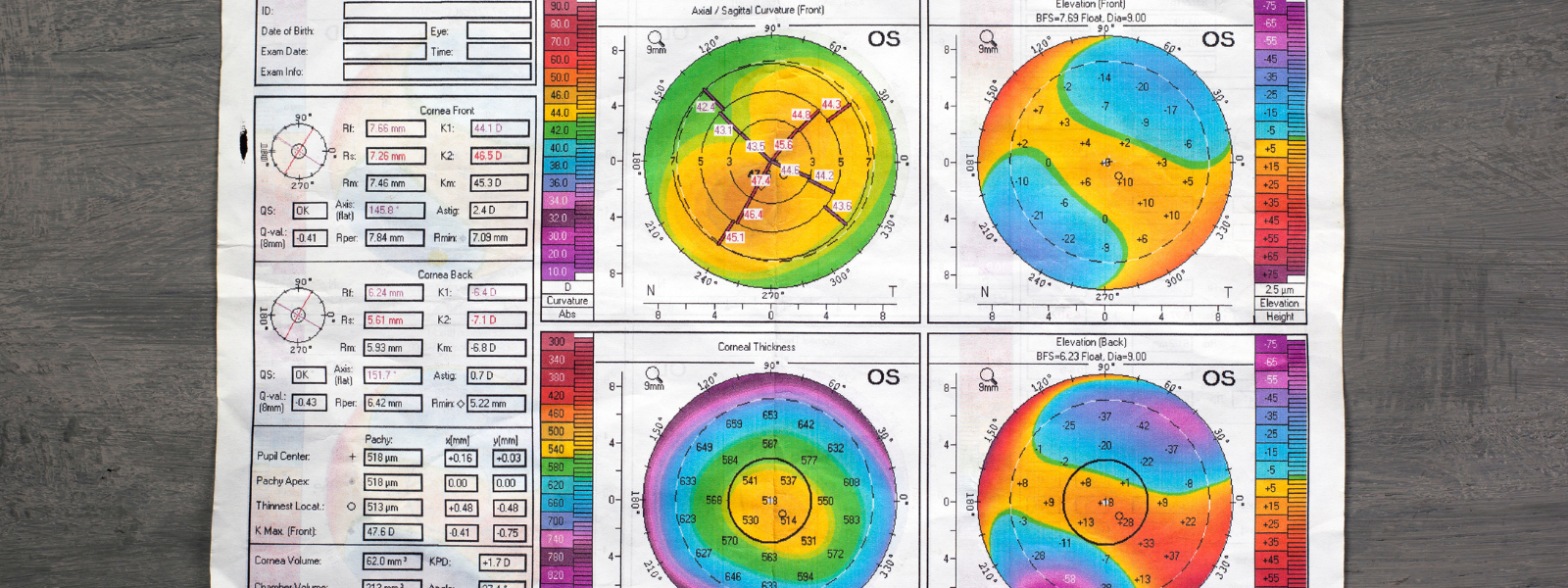 Menicon E-1 Keratokonus , (PDF) Keratoconus: An updated review – DDKGWB